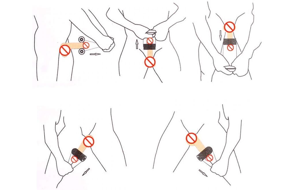 Jelqing dzimumlocekļa paplašināšanai